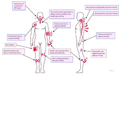 Motor Neuron Disease 2